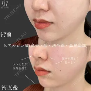 ziz CLINIC 村岡 史子医師の症例