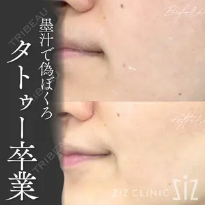 ziz CLINIC 村岡 史子医師の症例