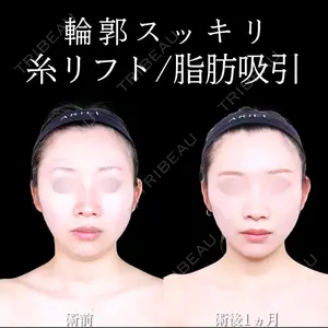 アリエル美容クリニック 水戸院 天白 典秀医師の症例