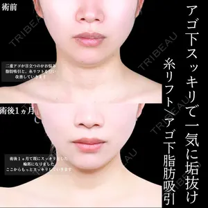アリエル美容クリニック 水戸院 天白 典秀医師の症例