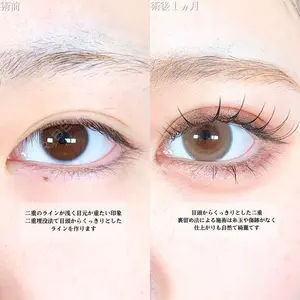 アリエル美容クリニック 大宮院 鈴木　桂介医師の症例