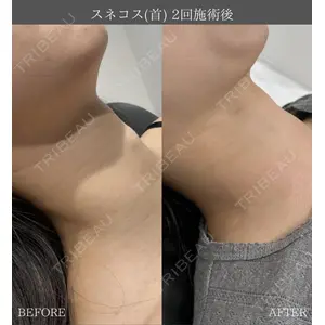 X CLINIC 大阪院 中田　征希医師の症例