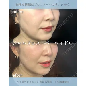 ルラ美容クリニック 高田馬場院 日名地 あゆみ医師の症例