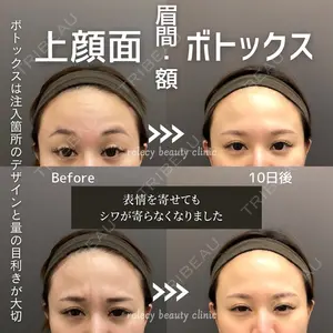 ロレシー美容クリニック 心斎橋駅前院 福留院長医師の症例