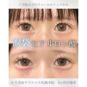 ルラ美容クリニック 札幌本院 田中 瑞希医師の症例