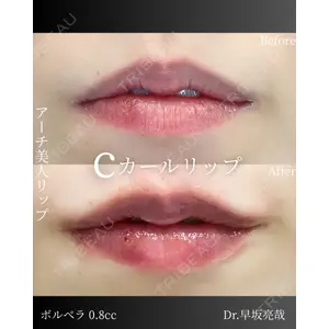 ルラ美容クリニック 札幌本院 早坂 亮哉医師の症例