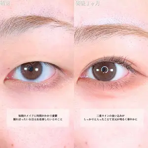 アリエル美容クリニック 横浜院 渡邉 光医師の症例
