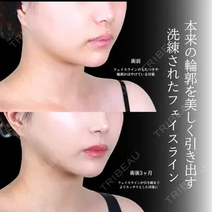 アリエル美容クリニック 横浜院 渡邉 光医師の症例