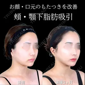 アリエル美容クリニック 横浜院 渡邉 光医師の症例