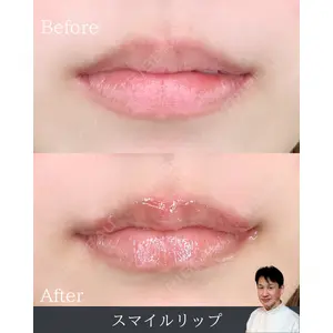 ルラ美容クリニック 渋谷本院 日下志 厳医師の症例
