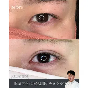 ルラ美容クリニック 渋谷本院 日下志 厳医師の症例