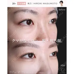 吉祥寺アイビークリニック 升本 浩紀医師の症例