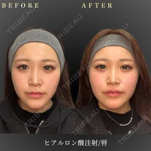 BiBiクリニック 山本 幸一郎医師の症例