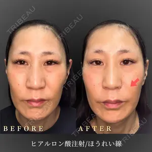 BiBiクリニック 山本 幸一郎医師の症例