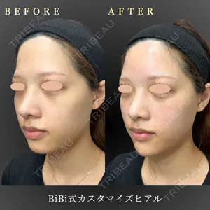BiBiクリニック 山本 幸一郎医師の症例
