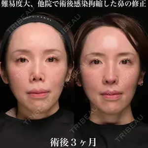 Zetith Beauty Clinic 銀座院 鉄 鑠医師の症例