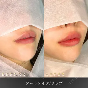 BiBiクリニックの症例
