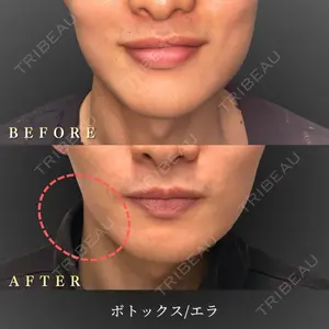 BiBiクリニック 山本 幸一郎医師の症例