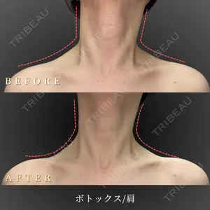 BiBiクリニック 山本 幸一郎医師の症例