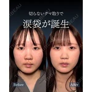 神戸美容外科 ネビュラクリニック 岩﨑 雅医師の症例