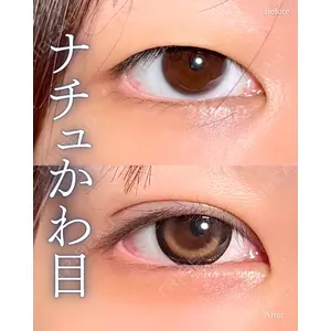 神戸美容外科 ネビュラクリニック 岩﨑 雅医師の症例