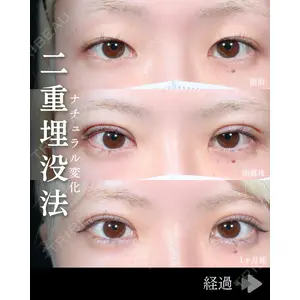 東京シンデレラ美容外科 池袋院 石井 達也医師の症例