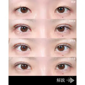 東京シンデレラ美容外科 池袋院 石井 達也医師の症例