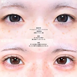 アリエル美容クリニック 大宮院 鈴木　桂介医師の症例