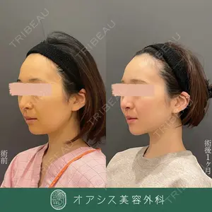 オアシス美容外科 遠藤 剛史医師の症例