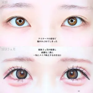 アリエル美容クリニック 水戸院 天白 典秀医師の症例