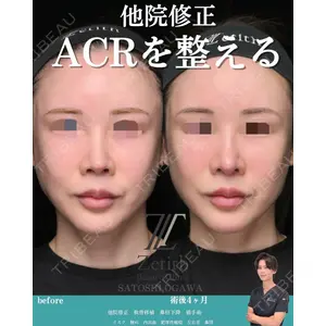 Zetith Beauty Clinic 銀座院の症例