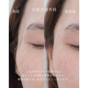 小暮整形外科・美容外科の症例