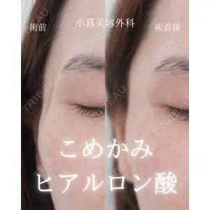 小暮整形外科・美容外科の症例