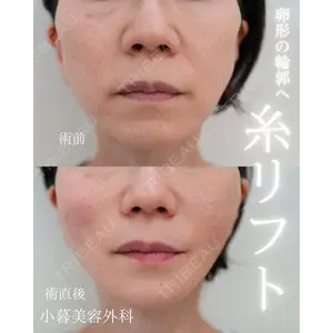 小暮整形外科・美容外科の症例