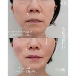 小暮整形外科・美容外科の症例