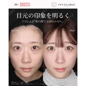 千葉美容外科アイビークリニックの症例