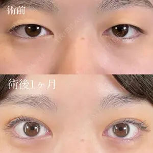 R Beauty CLINIC 銀座院 富田 莉沙子医師の症例