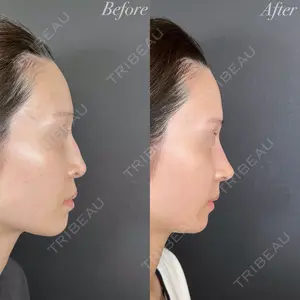 R Beauty CLINIC 大阪院 小池 泰弘医師の症例