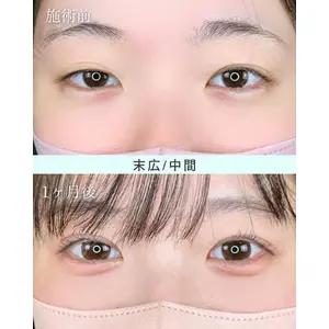 ルラ美容クリニック 福岡本院 樋勝 政博医師の症例