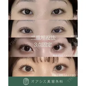 オアシス美容外科 遠藤 剛史医師の症例