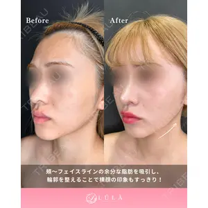 ルラ美容クリニック 新潟院 菊地 泰正医師の症例
