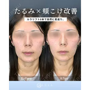 ルラ美容クリニック 新潟院 菊地 泰正医師の症例