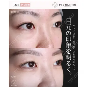 吉祥寺アイビークリニック 升本 浩紀医師の症例