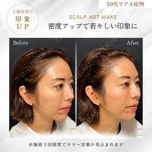 Wクリニック 心斎橋院の症例