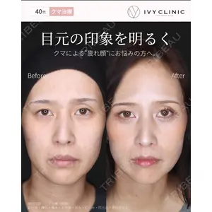 吉祥寺アイビークリニック 升本 浩紀医師の症例