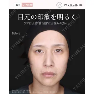 吉祥寺アイビークリニック 升本 浩紀医師の症例