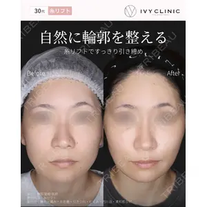 千葉美容外科アイビークリニック 藤田 愛樹医師の症例