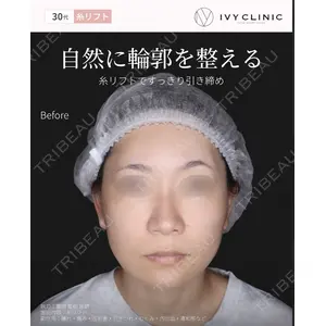 千葉美容外科アイビークリニック 藤田 愛樹医師の症例