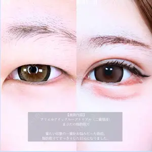 アリエル美容クリニック 郡山院 安齋 誠基医師の症例