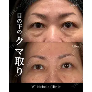愛知春日井美容外科ネビュラクリニック 都築 諒医師の症例